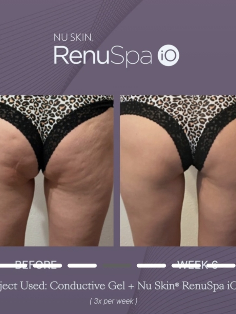Nu Skin RenuSpa iO